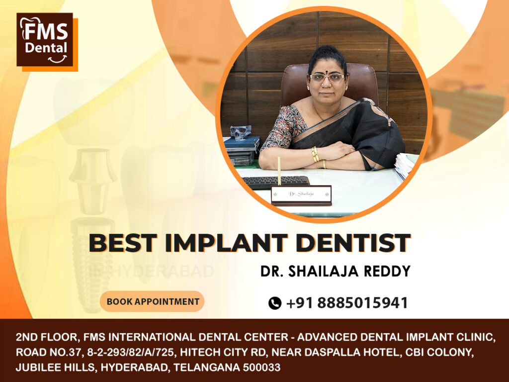 best-implant-dentist-8885015941