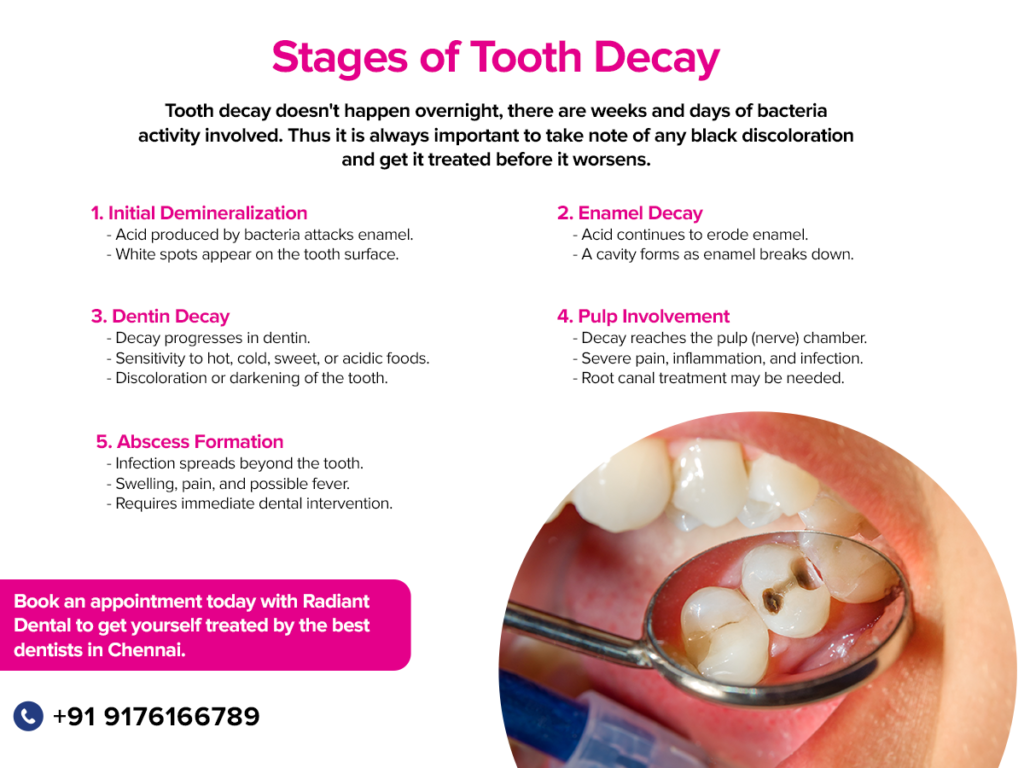 Dental-Filling-and-Tooth-Cavity-Filling-Cost-and-Causes-GMB