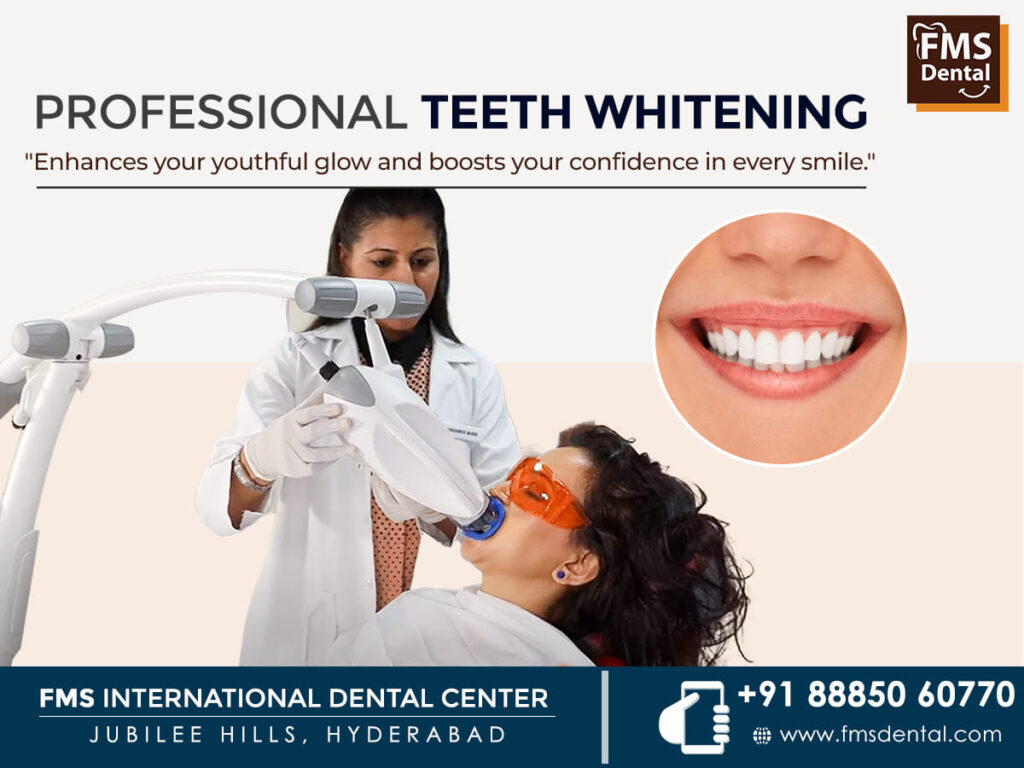 professional-teeth-whitening-in-jublee-hills-hyderabad